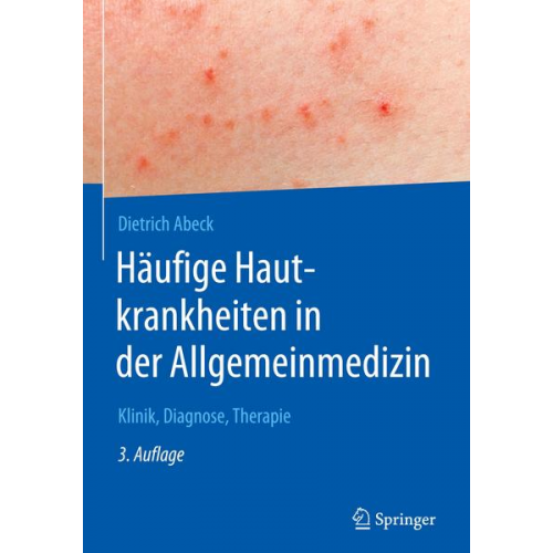 Dietrich Abeck - Häufige Hautkrankheiten in der Allgemeinmedizin