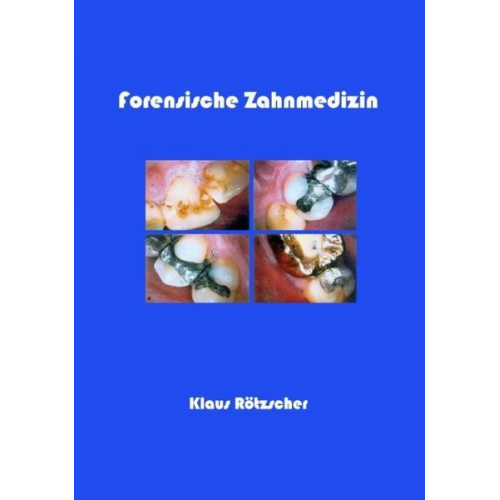 Klaus Rötzscher - Forensische Zahnmedizin