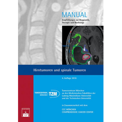 Hirntumoren und spinale Tumoren