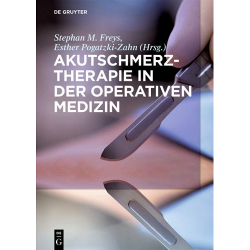 Akutschmerztherapie in der Operativen Medizin