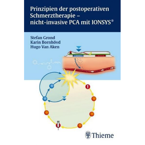 Hugo Van Aken & Karin Bornhövd & Stefan Grond - Prinzipien der postoperativen Schmerztherapie - Nichtinvasive PCA mit IONSYS®