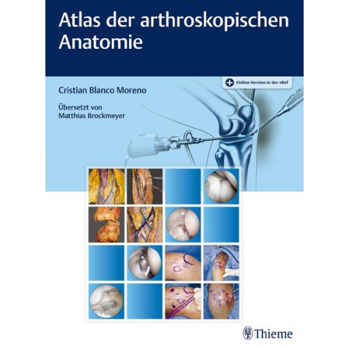 Cristian Blanco Moreno - Atlas der arthroskopischen Anatomie