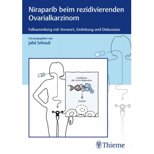 Niraparib beim rezidivierenden Ovarialkarzinom