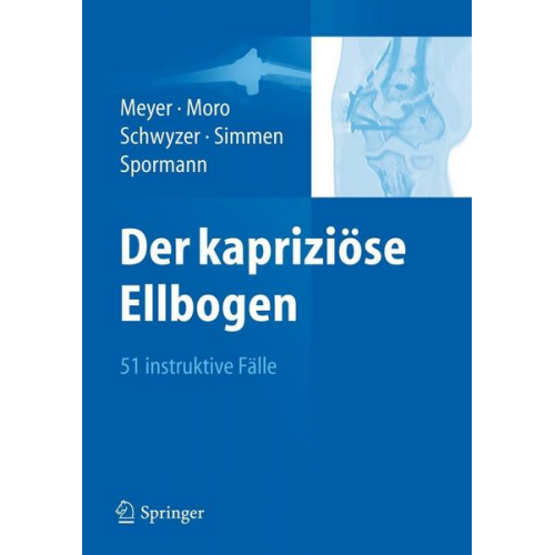 Der kapriziöse Ellbogen