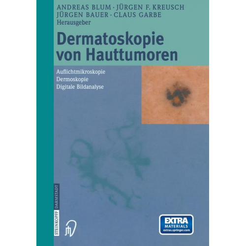 Dermatoskopie von Hauttumoren