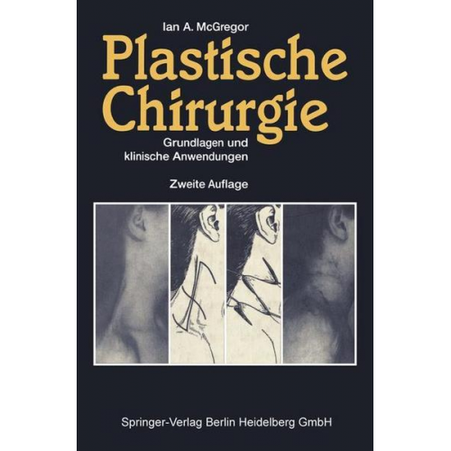 Ian A. McGregor - Plastische Chirurgie