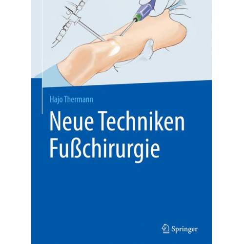 Hajo Thermann - Neue Techniken Fußchirurgie