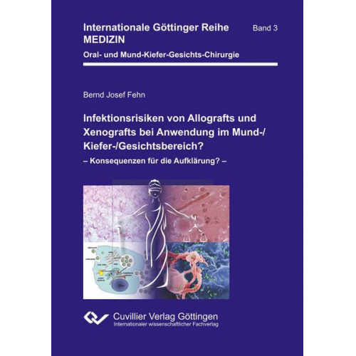 Bernd Josef Fehn - Infektionsrisiken von Allografts und Xenografts bei Anwendung im Mund-/Kiefer-/Gesichtsbereich?