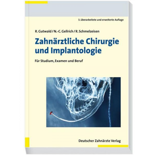 Ralf Gutwald & N.-C. Gellrich & Rainer Schmelzeisen - Zahnärztliche Chirurgie und Implantologie
