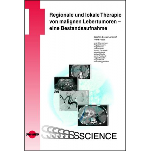 Joachim Boese-Landgraf & Franz Fobbe - Regionale und lokale Therapie von malignen Lebertumoren - eine Bestandsaufnahme