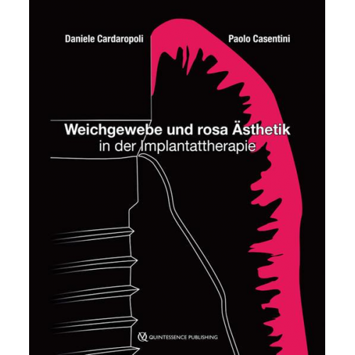 Daniele Cardaropoli & Paolo Casentini - Weichgewebe und rosa Ästhetik in der Implantattherapie