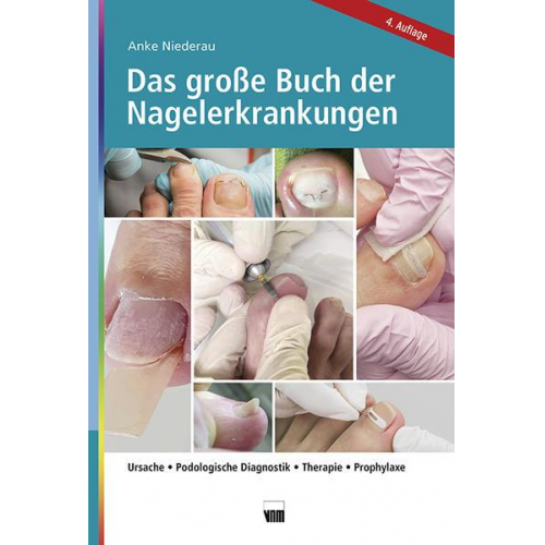 Anke Niederau - Das große Buch der Nagelerkrankungen