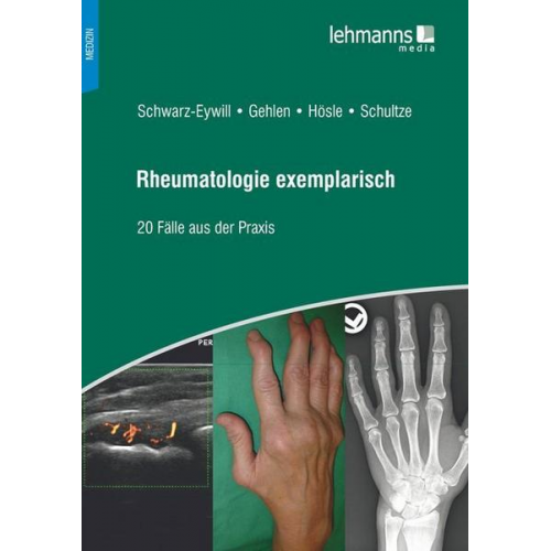 Michael Schwarz-Eywill & Martin Gehlen & Rosmarie Hösle & Mareen Schultze - Rheumatologie exemplarisch