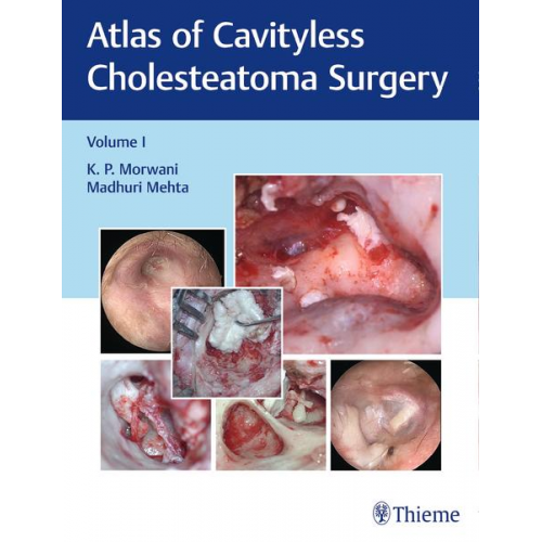 K. Morwani & Madhuri Mehta - Atlas of Cavityless Cholesteatoma Surgery, Vol 1