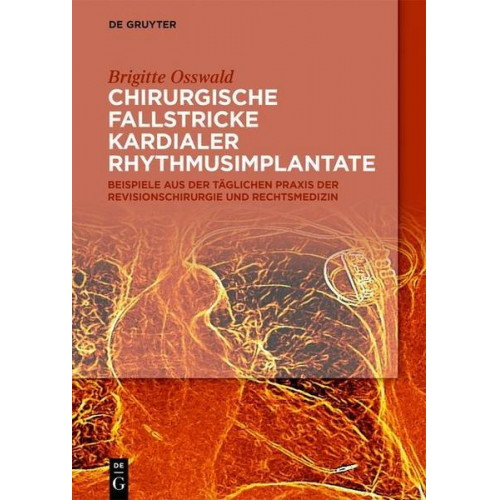 Brigitte Osswald - Chirurgische Fallstricke kardialer Rhythmusimplantate