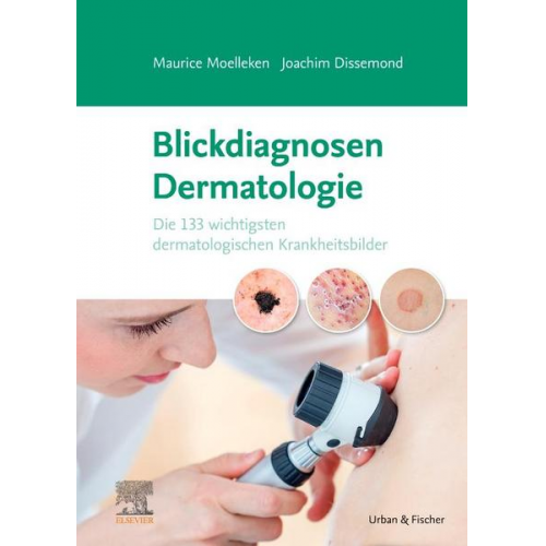 Maurice Moelleken & Joachim Dissemond - Blickdiagnosen Dermatologie