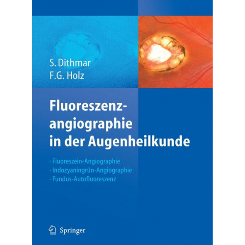 Stefan Dithmar & Frank G. Holz - Fluoreszenzangiographie in der Augenheilkunde
