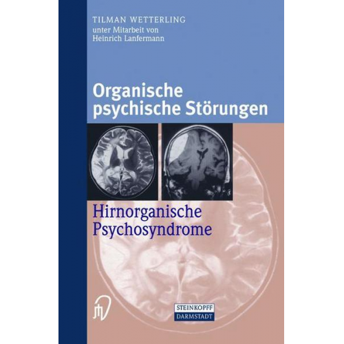 Tilman Wetterling - Organische psychische Störungen