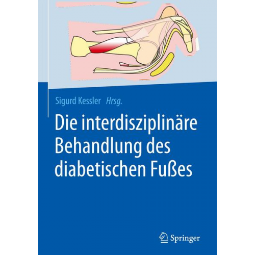 Die interdisziplinäre Behandlung des diabetischen Fußes