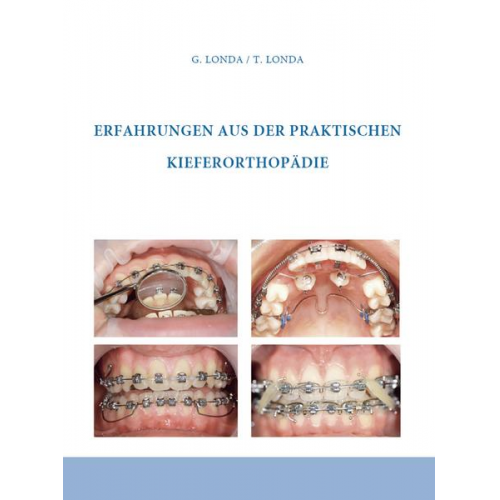 Gennadij Londa & Theresia Londa - Erfahrungen aus der praktischen Kieferorthopädie