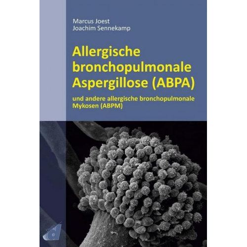 Marcus Joest & Joachim Sennekamp - Allergische bronchopulmonale Aspergillose (ABPA)