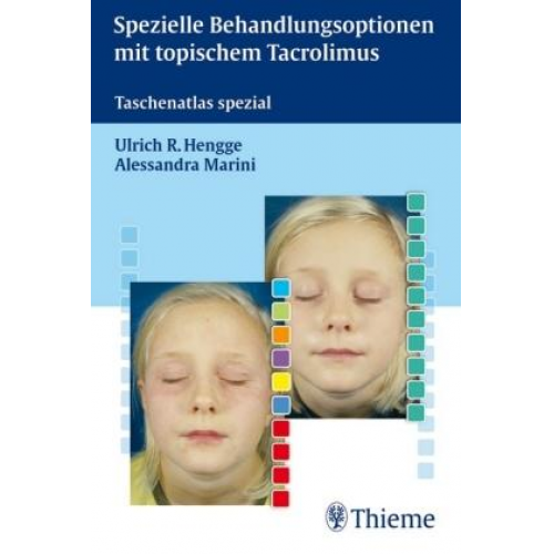 Ulrich R. Hengge & Alessandra Marini - Spezielle Behandlungsoptionen mit topischem Tacrolimus