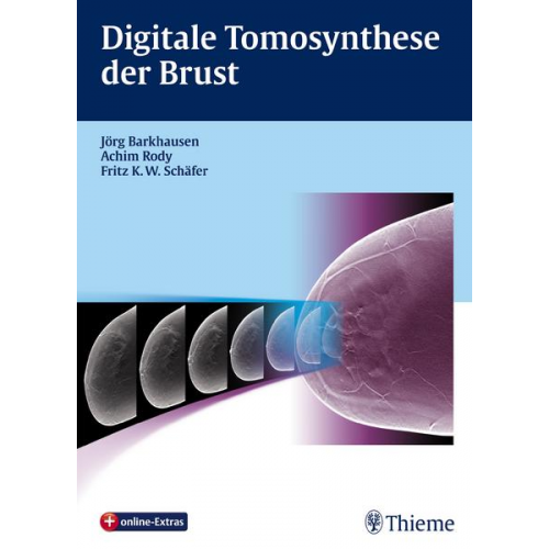 Jörg Barkhausen & Achim Rody & Fritz K. W. Schäfer - Digitale Tomosynthese der Brust