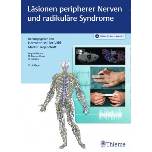 Läsionen peripherer Nerven und radikuläre Syndrome