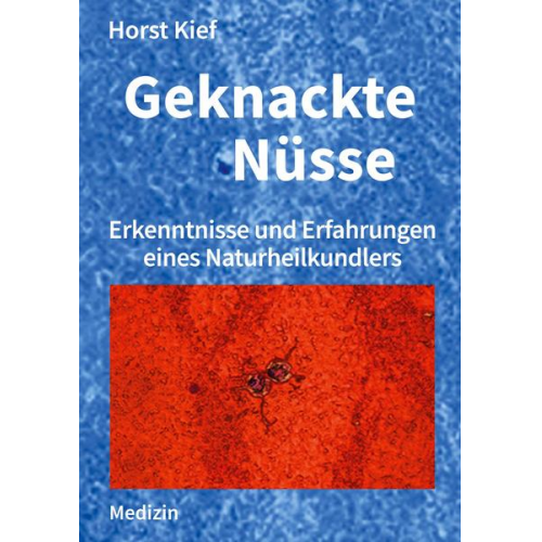 Horst Kief - Geknackte Nüsse