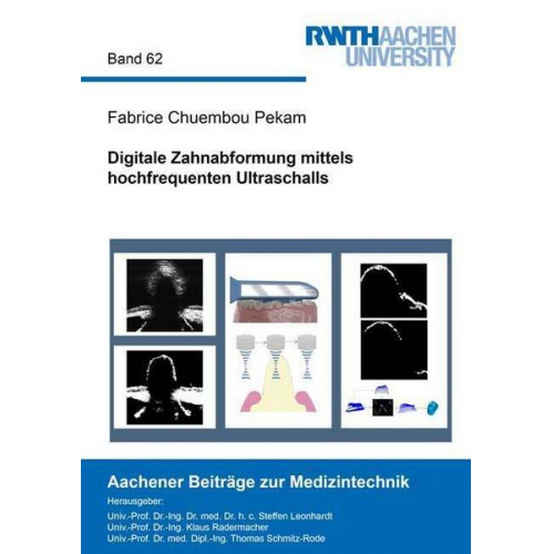 Fabrice Chuembou Pekam - Digitale Zahnabformung mittels hochfrequenten Ultraschalls