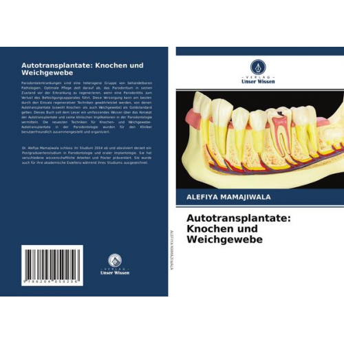 Alefiya Mamajiwala - Autotransplantate: Knochen und Weichgewebe