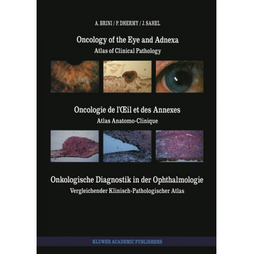 A. Brini & A. Dhermy & J. Sahel - Oncology of the Eye and Adnexa / Oncologie de l’Œil et des Annexes / Onkologische Diagnostik in der Ophthalmologie