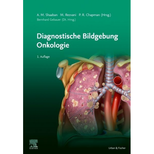 Shaaban Akram M. - Diagnostische Bildgebung Onkologie