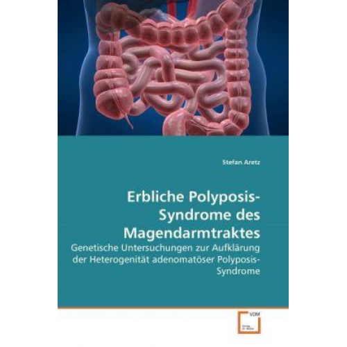 Stefan Aretz - Aretz, S: Erbliche Polyposis-Syndrome des Magendarmtraktes