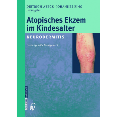 Atopisches Ekzem im Kindesalter (Neurodermitis)