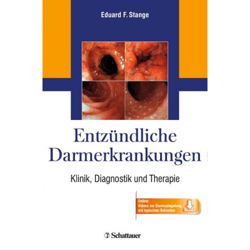 Entzündliche Darmerkrankungen