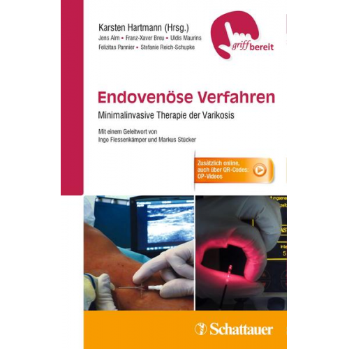 Jens Alm & Franz-Xaver Breu & Uldis Maurins & Felizitas Pannier & Stefanie Reich-Schupke - Endovenöse Verfahren