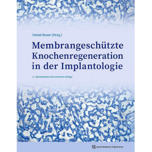 Membrangeschützte Knochenregeneration in der Implantologie