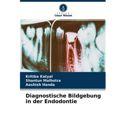 Kritika Katyal & Shantun Malhotra & Aashish Handa - Diagnostische Bildgebung in der Endodontie