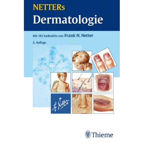 Frank H. Netter - NETTERs Dermatologie