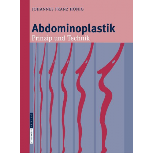 Johannes-Franz Hönig - Abdominoplastik