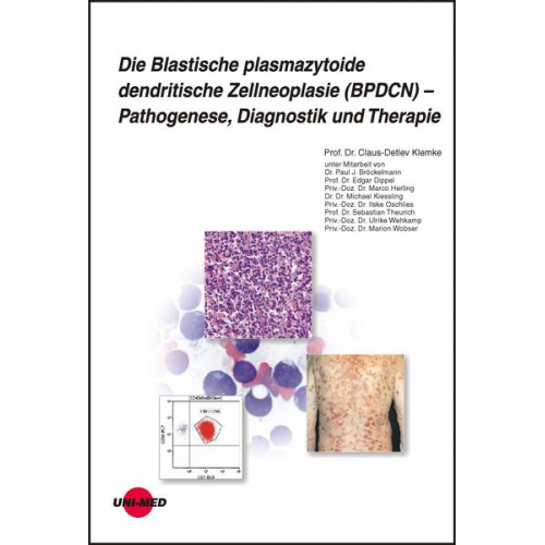 Claus-Detlev Klemke - Die Blastische plasmazytoide dendritische Zellneoplasie (BPDCN) – Pathogenese, Diagnostik und Therapie