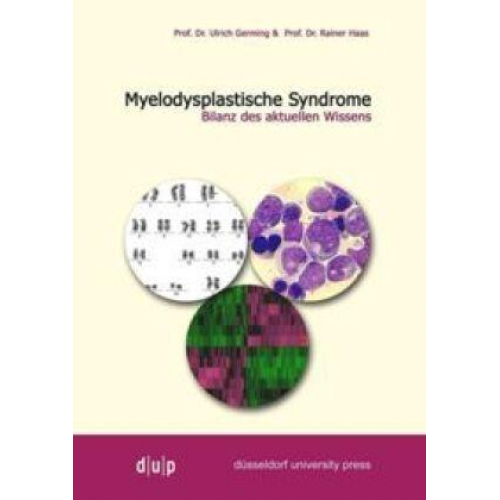 Rainer Haas - Myelodysplastiche Syndrome