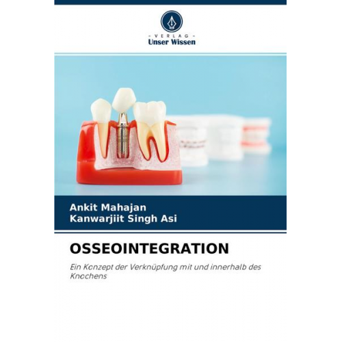 Ankit Mahajan & Kanwarjiit Singh Asi - Osseointegration