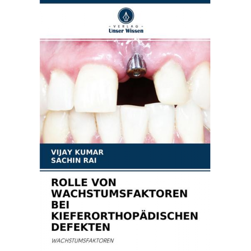 Vijay Kumar & Sachin Rai - Rolle von Wachstumsfaktoren bei Kieferorthopädischen Defekten