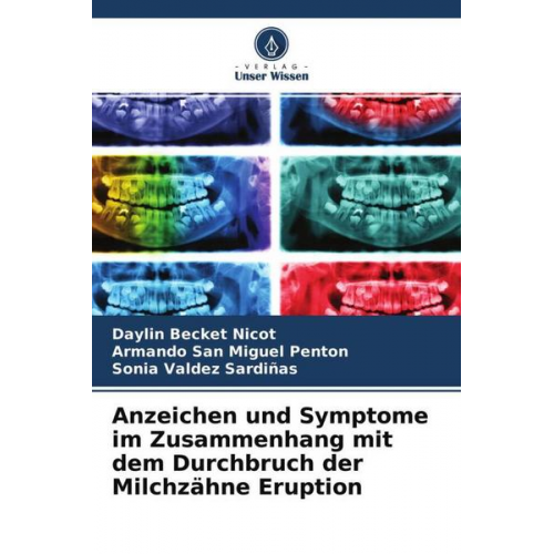 Daylin Becket Nicot & Armando San Miguel Penton & Sonia Valdez Sardiñas - Anzeichen und Symptome im Zusammenhang mit dem Durchbruch der Milchzähne Eruption