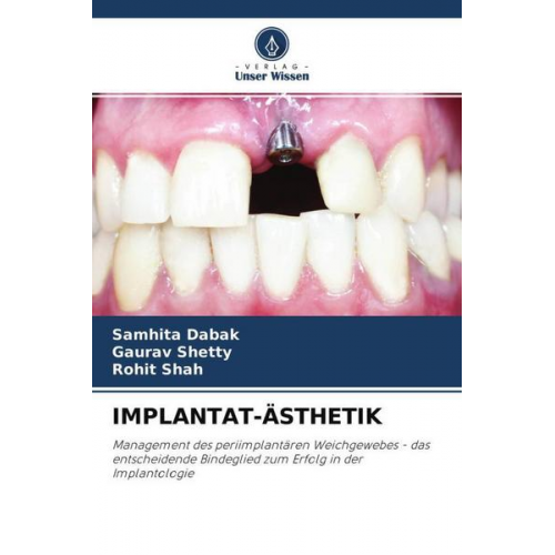 Samhita Dabak & Gaurav Shetty & Rohit Shah - Implantat-Ästhetik