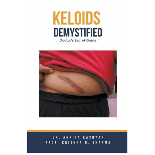 Ankita Kashyap Krishna N. Sharma - Keloids Demystified