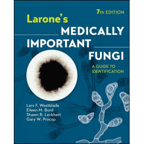 Lars F. Westblade Eileen M. Burd Shawn R. Lockhart Gary W. Procop - Larone's Medically Important Fungi