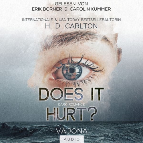 H. D. Carlton - Does It Hurt?